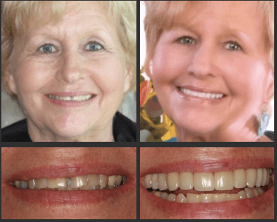 Advanced Dentistry of Amarillo
