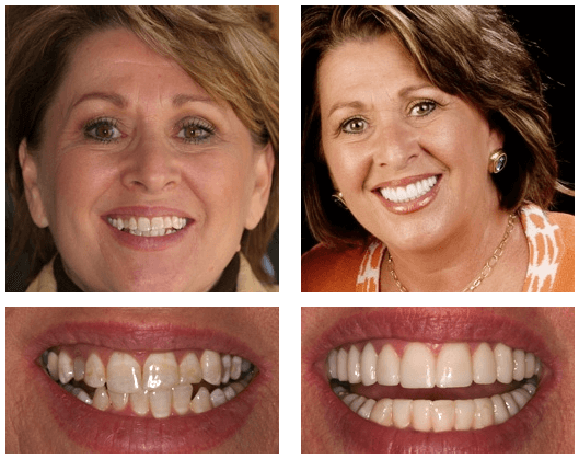 Advanced Dentistry of Amarillo