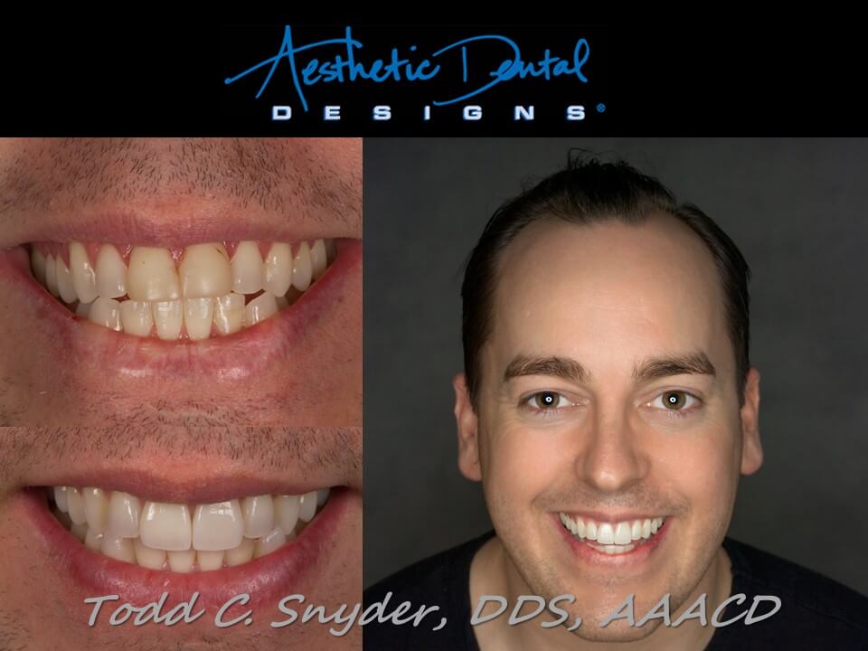 Aesthetic Dental Designs/Todd Snyder, DDS