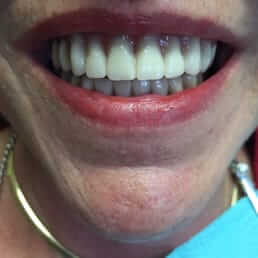 Associates Dentist Holpuch Kiefer