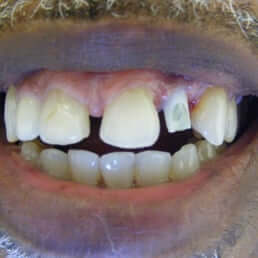 Bluegrass Endodontics
