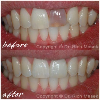 Dental Expressions - Richard T. Masek DDS, Inc.