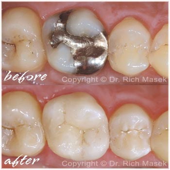 Dental Expressions - Richard T. Masek DDS, Inc.