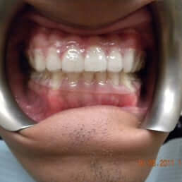 Guajardo Orthodontics Baytown