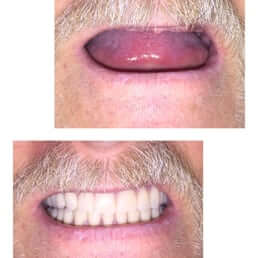 McAfee Dental